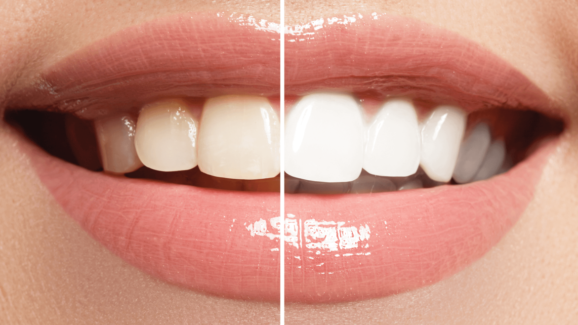 Cosmetic and Restorative Dentistry